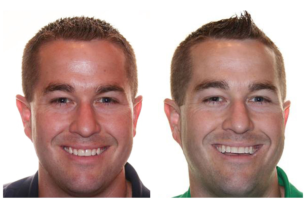 Brunswick Family Dental and Implant Center