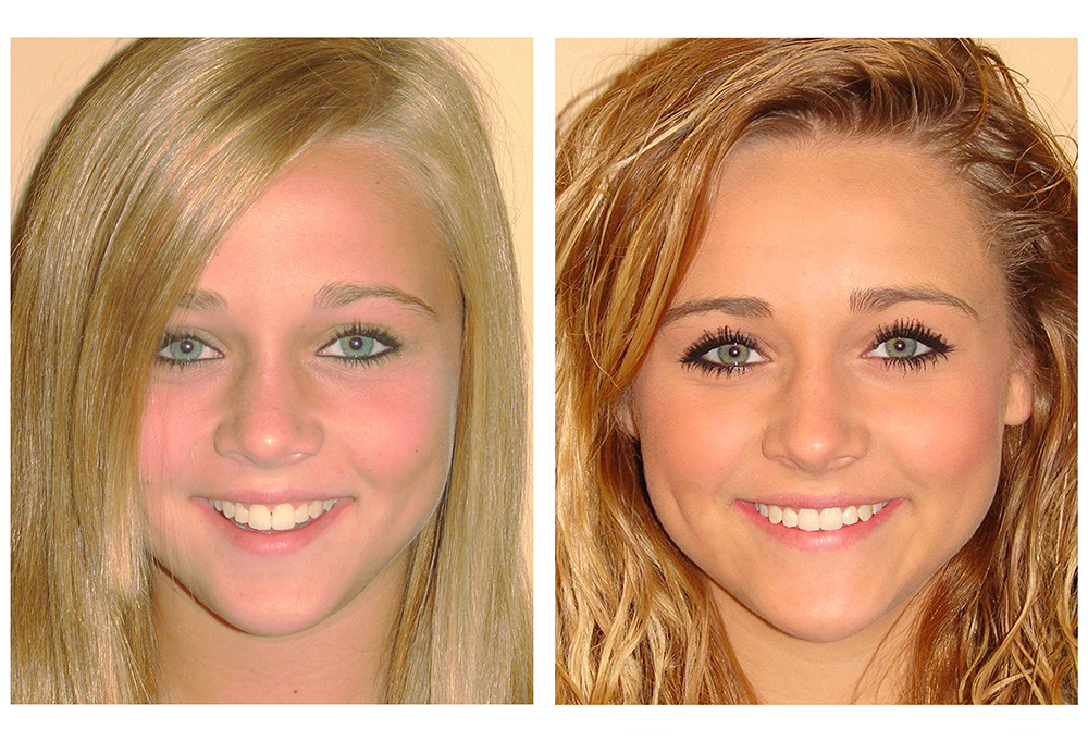 Brunswick Family Dental and Implant Center