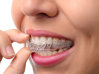 The image features a person with clear braces, their hand holding the braces in place while they appear to be examining them closely.