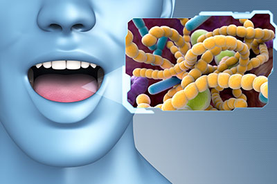 A 3D rendering of a human head with an open mouth next to a microscopic image of bacteria, illustrating the concept of oral health and bacterial infection.