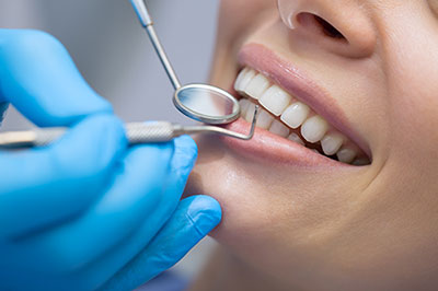 A dental hygienist performing a teeth cleaning procedure, with a patient s mouth open and a toothbrush in use.