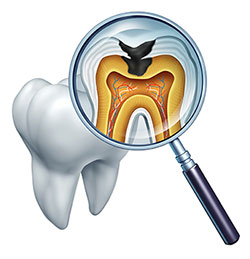 The image shows a close-up view of a human tooth with an open crown, revealing the pulp chamber and root canal system. A magnifying glass is superimposed on the tooth to indicate examination or inspection, and there s a detailed 3D rendering inside the glass showing the internal structure of the tooth including the pulp chamber, root canals, and nerves. The background is white, which highlights the subject.