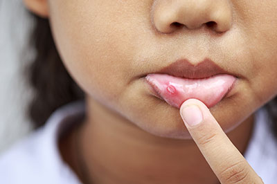 A young child with their finger on a pimple, close-up.