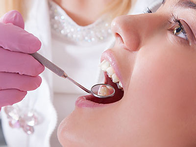 A dental professional performing a dental procedure on a patient with a focus on oral hygiene.